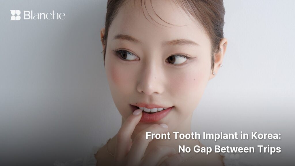 Front Tooth Implant in Korea No Gap Between Trips