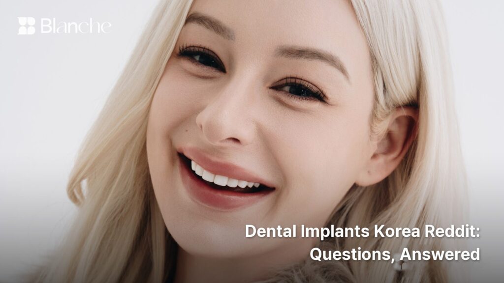 Dental Implants Korea Reddit Questions, Answered