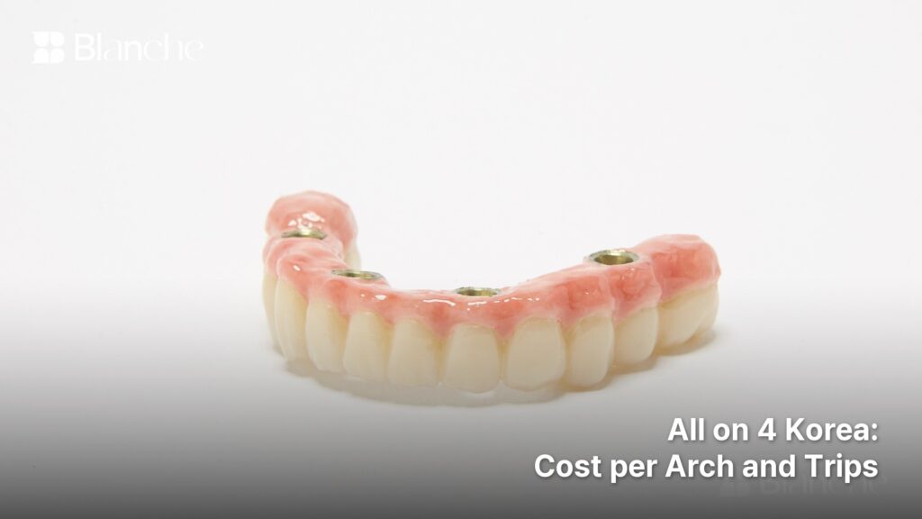 All on 4 Korea Cost per Arch and Trips