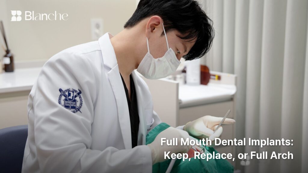 Full Mouth Dental Implants Keep, Replace, or Full Arch