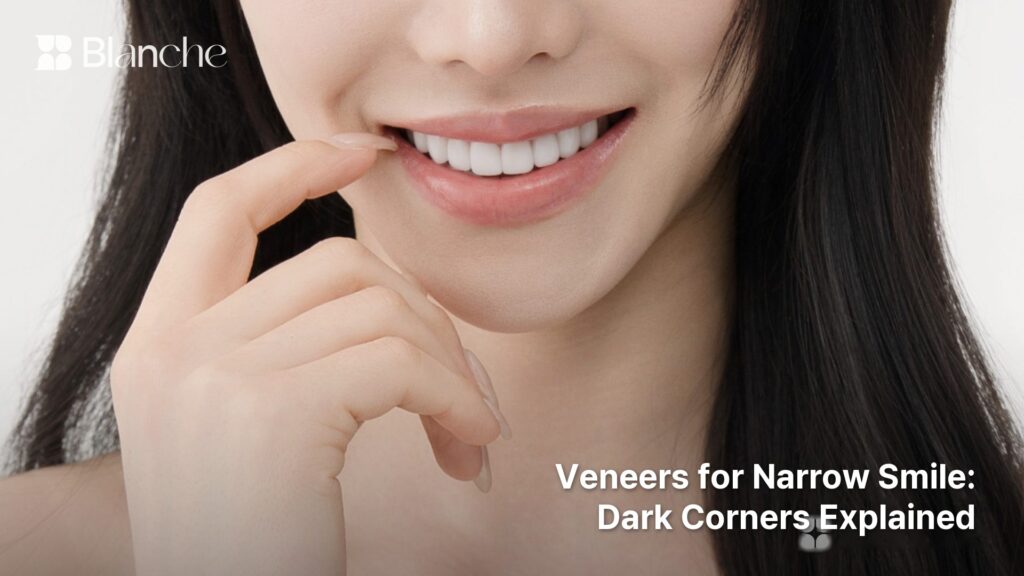 Veneers for Narrow Smile Dark Corners Explained