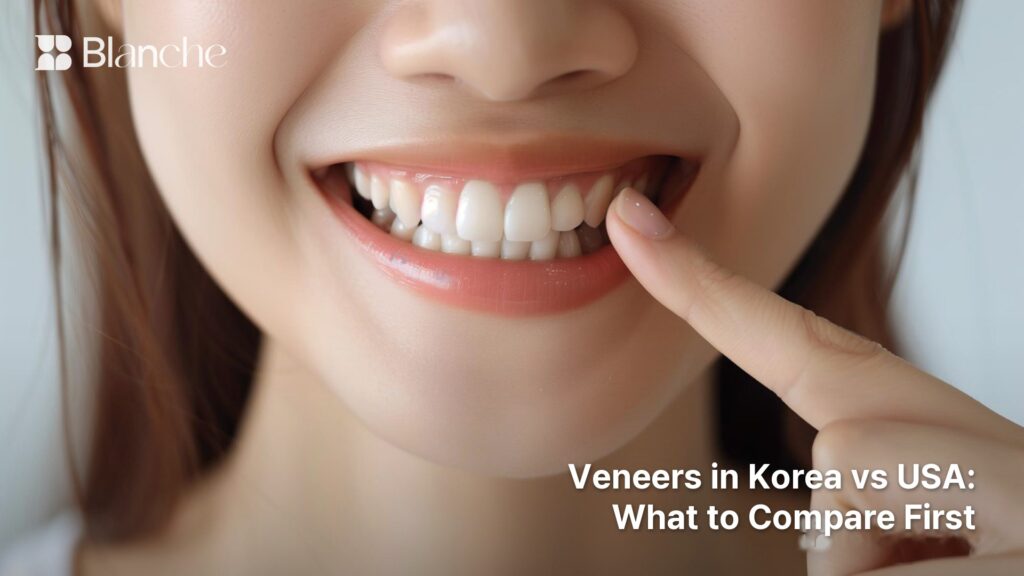 Veneers in Korea vs USA What to Compare First