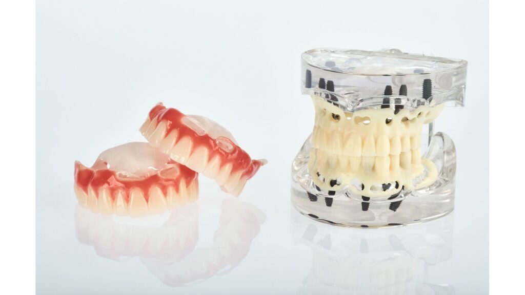 Full-arch implant models