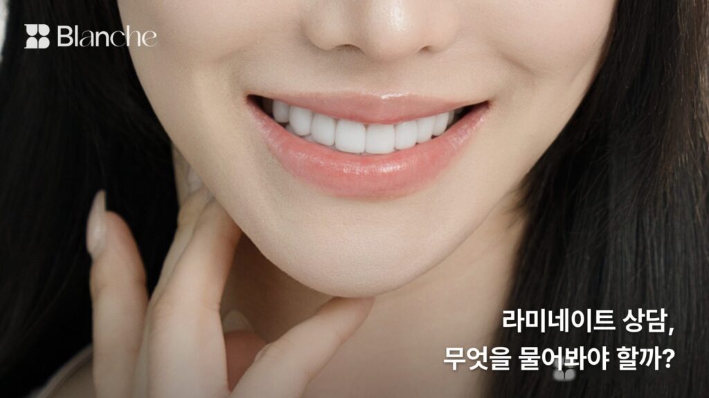 라미네이트 상담, 무엇을 물어봐야 할까