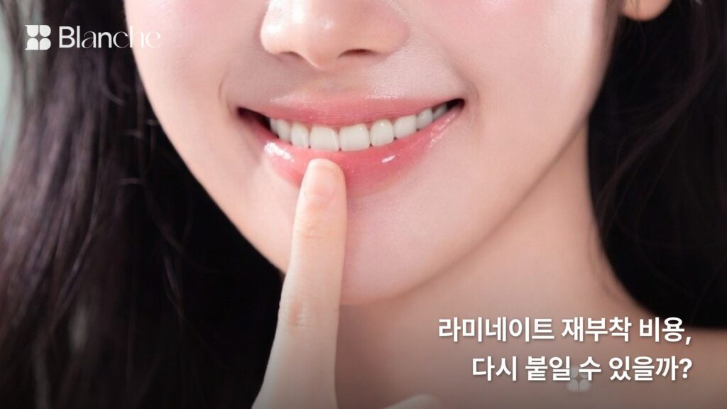 라미네이트 재부착 비용, 떨어진 라미네이트 다시 붙일 수 있을까