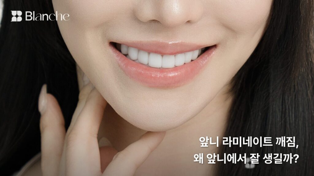 앞니 라미네이트 깨짐, 왜 앞니에서 잘 생길까