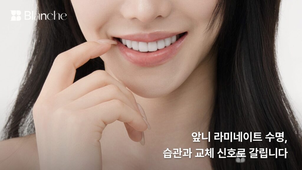 앞니 라미네이트 수명, 왜 앞니가 더 신경 쓰일까